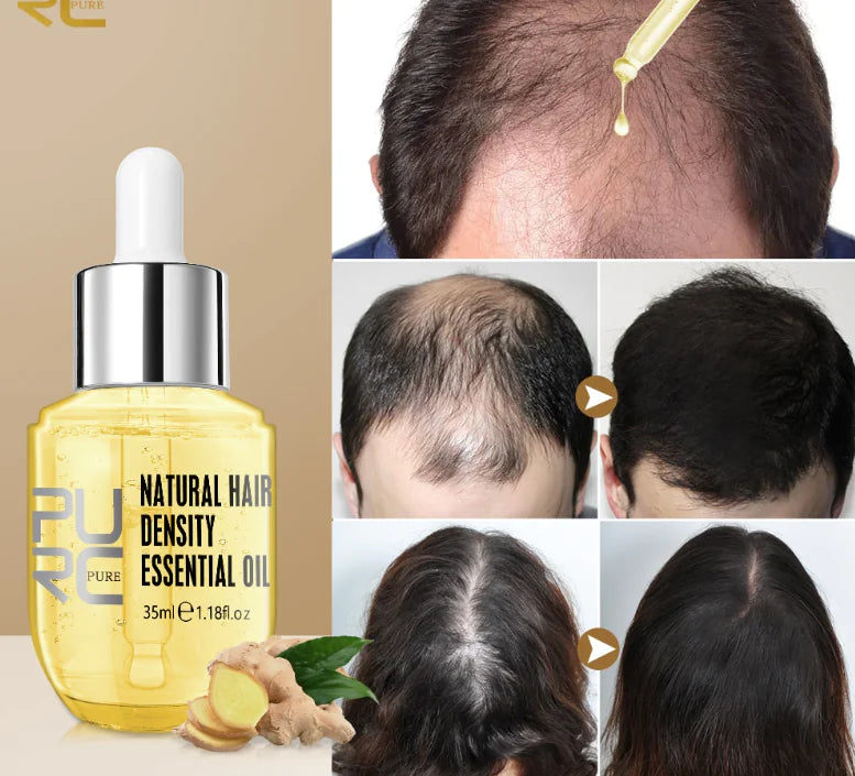 Revitalize Your Hair with Natural Ginger Hair Growth Oil - The Bargain Fest